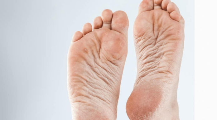 Get Smooth and Soft Heels with this Natural and Affordable DIY Solution