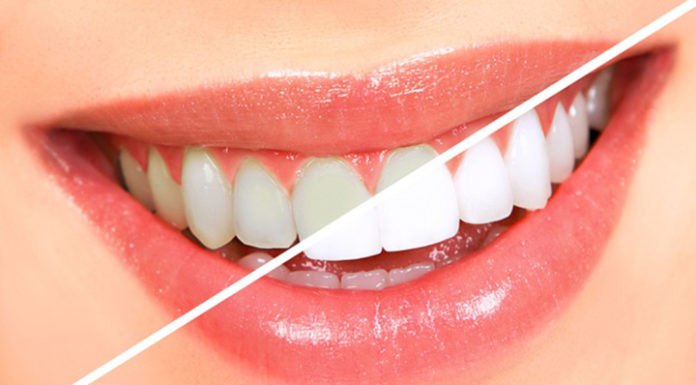 The secrets to whitening teeth and freshening breath lie in these discarded items