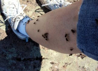 Why do flies like to land on people even though they don’t suck blood or bite flesh?