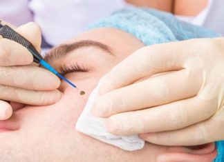 The Hazards of Mole Removal: Why DIY is a Dangerous Path to Tread