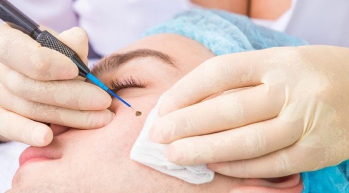 The Hazards of Mole Removal: Why DIY is a Dangerous Path to Tread