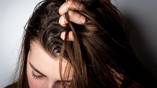 6 Ways to Revive Greasy Hair and Regain Your Confidence