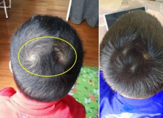 Does the swirl on the head correlate with a child’s IQ, future success, and wealth?