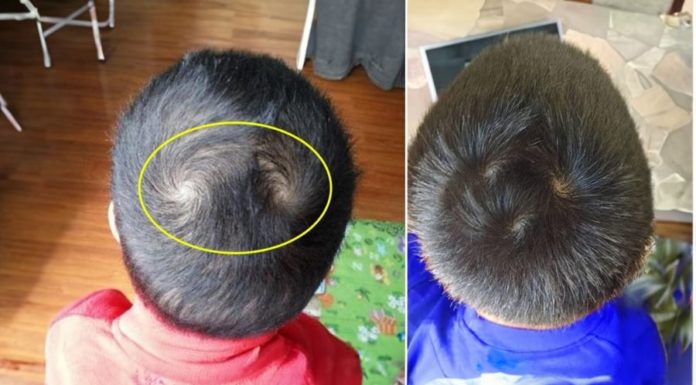 Does the swirl on the head correlate with a child’s IQ, future success, and wealth?