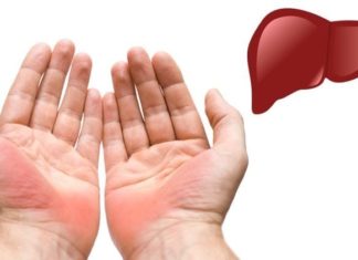 300 Acupuncture Points Converge in Your Hands: 3 Warning Signs of Malignant Tumor Formation, No Cause for Celebration