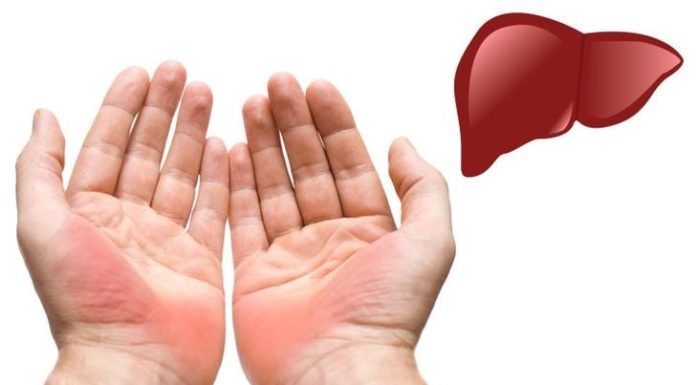 300 Acupuncture Points Converge in Your Hands: 3 Warning Signs of Malignant Tumor Formation, No Cause for Celebration