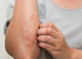 3 Safe and Effective Ways to Brighten Chapped Skin and Achieve a Whiter Complexion