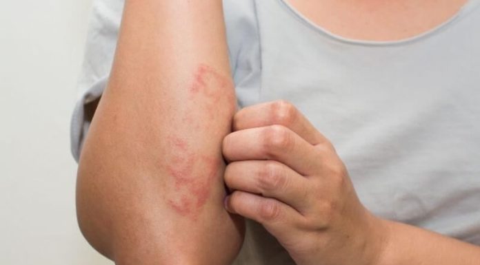 3 Safe and Effective Ways to Brighten Chapped Skin and Achieve a Whiter Complexion