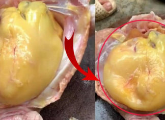 Chicken Belly: The Wise Keep, The Foolish Dump