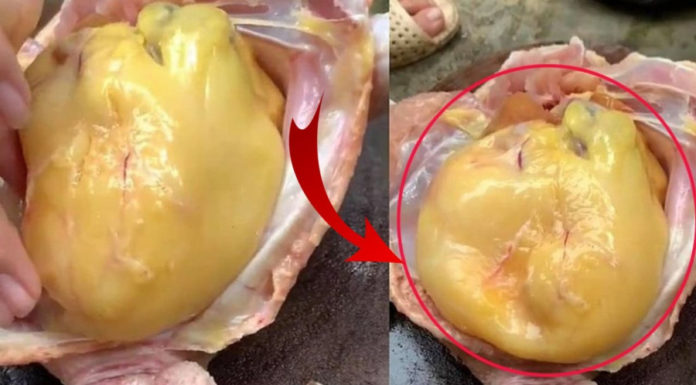 Chicken Belly: The Wise Keep, The Foolish Dump