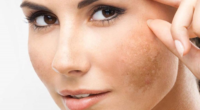 Quick and easy tips to revive dry skin for a smooth and hydrated complexion