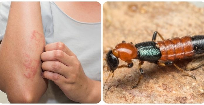 Simple and Efficient Ways to Eliminate Ants in Apartments