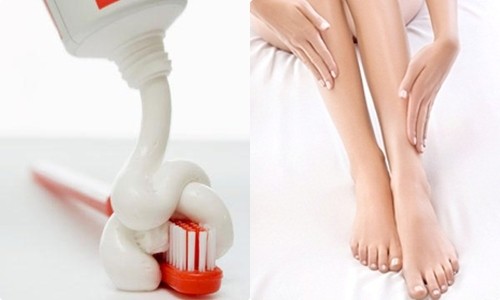 Safe and Natural Home Remedies for Hair Removal on Legs