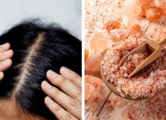 Use Common Spice to Clean Your Scalp and Reduce Dandruff and Hair Loss
