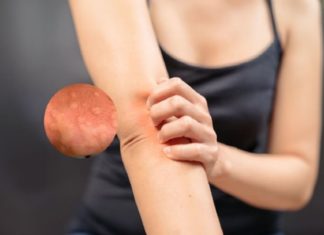 Check for Kidney Disease if You Experience Itching or Muscle Cramps Today