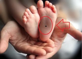 Children with these 3 birthmarks will have a bright future, parents are fortunate