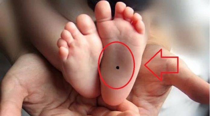 Children with these 3 birthmarks will have a bright future, parents are fortunate