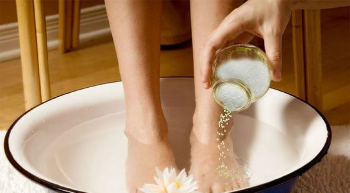 Tips for treating a sprained ankle