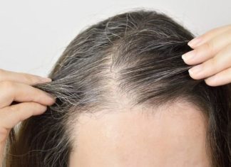 Lock in these natural tips to protect premature gray hair and confidently flaunt your beauty.