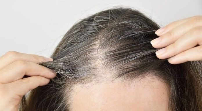Lock in these natural tips to protect premature gray hair and confidently flaunt your beauty.