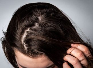 Tips for Dealing with Greasy Hair that Affects your Confidence
