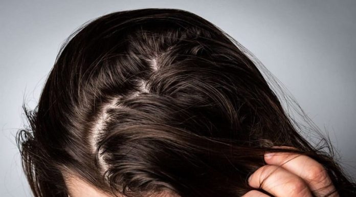 Tips for Dealing with Greasy Hair that Affects your Confidence