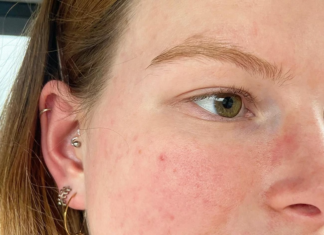 Add this type of tea to your skincare routine for age-defying results and radiant, protected skin