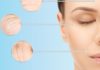 5 Strategies to Combat Saggy Skin and Stave Off Aging