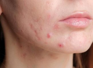 “Unlock 8 Amazing Beauty Secrets with Everyday Aspirin!”