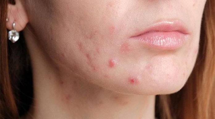 “Unlock 8 Amazing Beauty Secrets with Everyday Aspirin!”