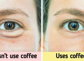 Tips for Reducing Dark Circles and Eye Fatigue
