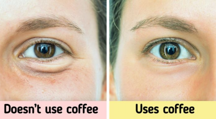 Tips for Reducing Dark Circles and Eye Fatigue