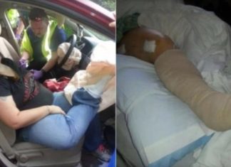 Why you should never put your feet on the car dashboard, even when stopped