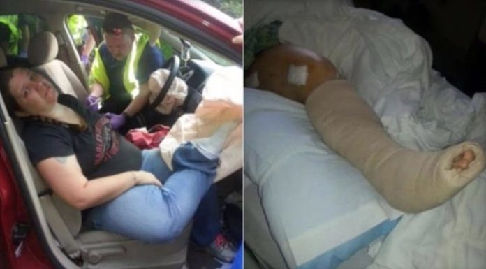 Why you should never put your feet on the car dashboard, even when stopped