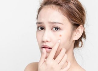 Discovering the Causes Behind 9 Natural Remedies for Treating Acne