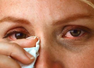 Coping with Conjunctivitis During Floods: Causes, Symptoms, and Prevention Strategies