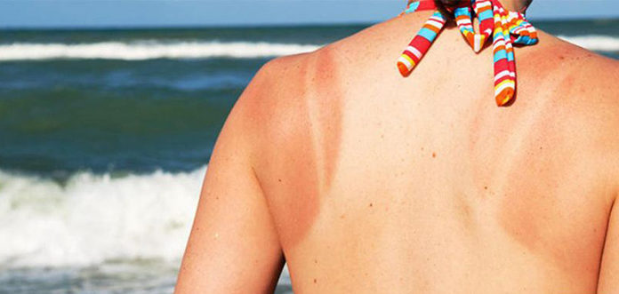 How to Treat 5 Common Skin Issues During Hot Weather