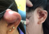 The Complete Alphabetical Guide to Caring for New Piercings
