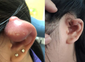 The Complete Alphabetical Guide to Caring for New Piercings
