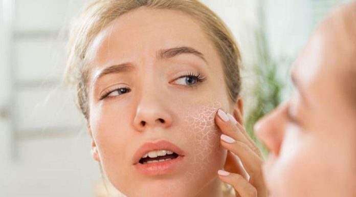 5 Ways to Rescue Flawed Skin in the Days Leading Up to Lunar New Year