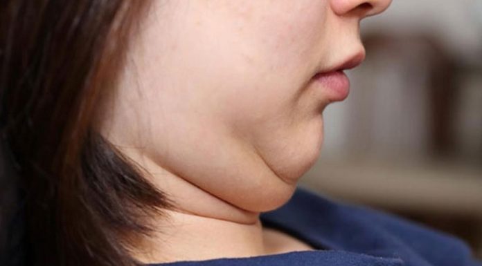 Exploring the Effectiveness of Exercise for Creating Facial Slimming