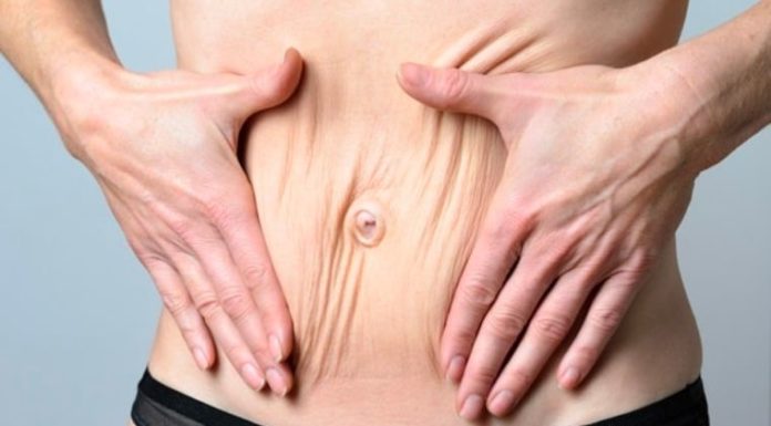 4 Tips to Fix Postpartum Skin Sagging and Restore Smooth, Firm Skin