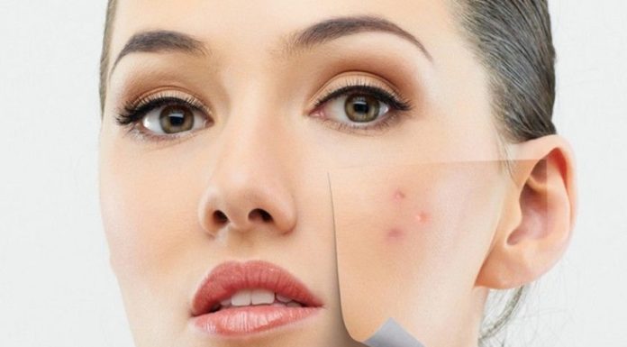 Advice on Using Facial Cleansers for Acne-Prone Skin