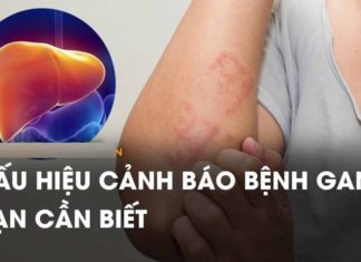 1 “Symptom” your body makes, beware of severe liver disease, treating it is difficult