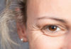 Eight Strategies for Preserving the Skin Around the Eyes & Fighting Aging Symptoms