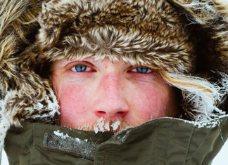Unraveling the Mystery Behind Cold Weather Allergies – Causes, Symptoms, Prevention, and Treatment