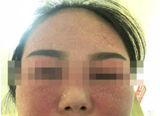 Alternative Solutions to Skin Whitening Cosmetics