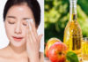 Magical beauty recipes with apple cider vinegar, say goodbye to all skin imperfections