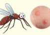 “What Causes Mosquitoes to Bite You More than Others?”