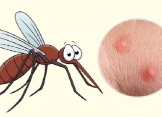 “What Causes Mosquitoes to Bite You More than Others?”